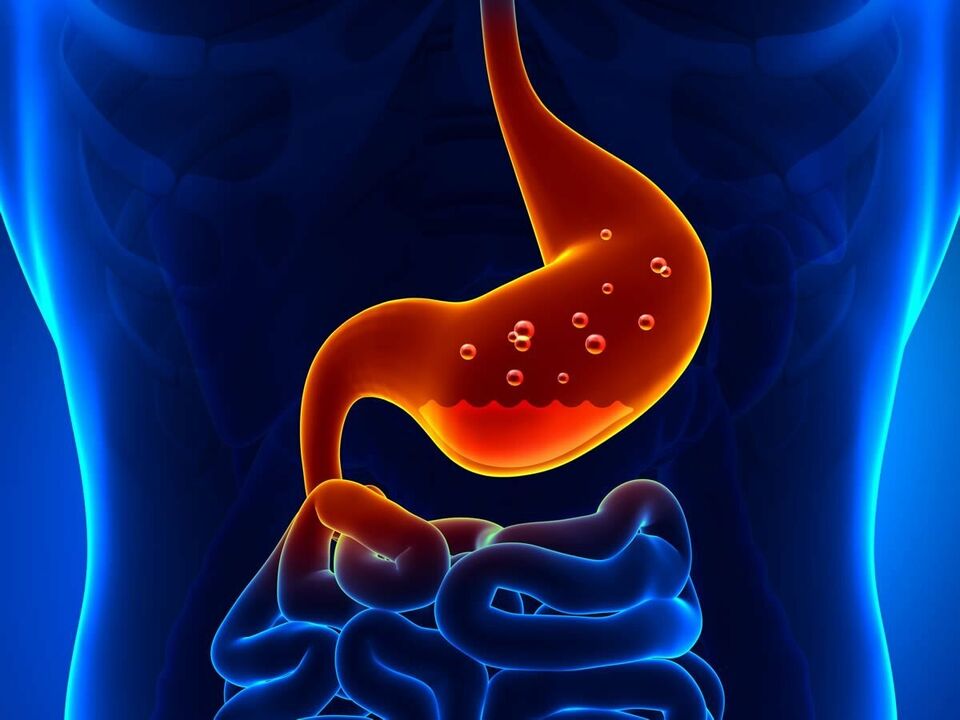 La gastrite è una malattia infiammatoria dello stomaco che richiede una dieta